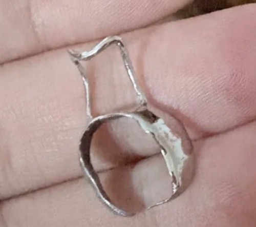 儿童拔牙后安装间隙保持器：真实价格与“后悔”背后的隐形代价分享