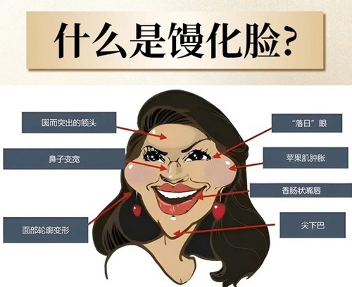 曾德浩修复馒化脸技术好吗？全息六维智能馒化消融术功能与美学兼顾