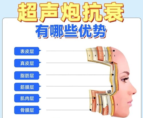 无创抗衰天花板—半岛超声炮适合什么人使用？多久做一次？治疗后多久可以看到效果?