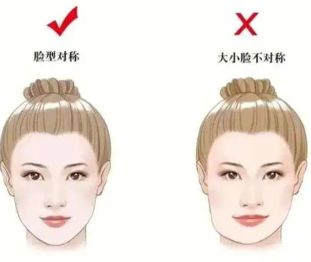 大小脸矫正需要多少钱？正颌5w起/磨骨手术20000元起