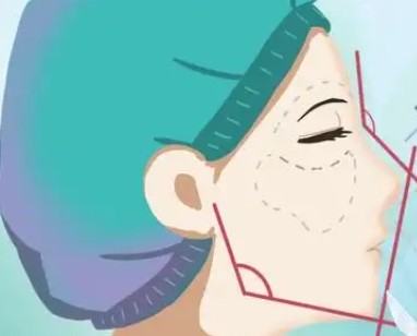 沈阳做鼻子有名的医生有哪些？朱石江、王松、龙放隆鼻技术好