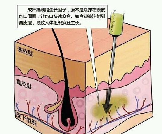 南京生长因子取出医院哪家好？