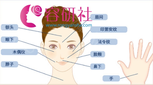 日本圣心医疗美容医院PRP皮肤美容再生疗法适用人群