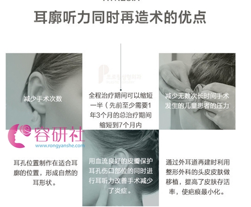 韩国普露菲耳proflie整形医院耳廓听力同时再造术的优点