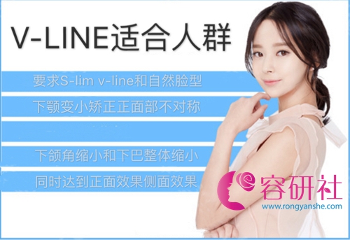 韩国普罗菲耳profile医院v-line手术适合人群