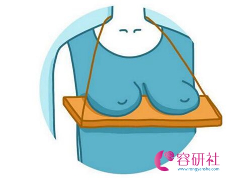 韩国profile普罗菲耳医院胸部下垂