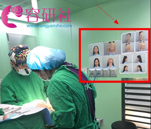 普罗菲耳profile新氧达人陈米拉鼻修复手术