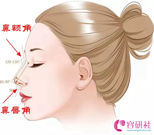北京米杨丽格巫文云膨体隆鼻：鼻额角，鼻唇角的塑造对于一个完美的鼻子来说有多重要？