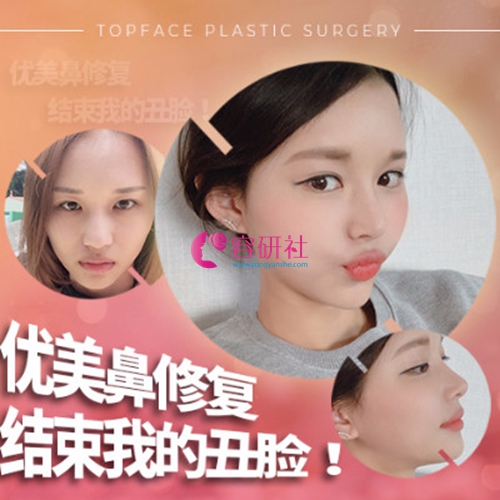 韩国秀美颜整形外科鼻部综合案例