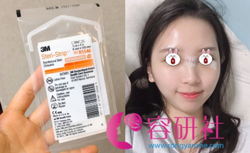 韩国Dr.ham整形外科疤痕治疗后的高免缝合3M胶带