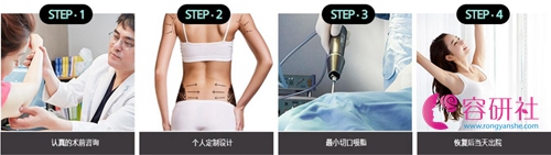 韩国维摩整形医院吸脂手术过程