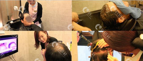 韩国毛杰琳整形外科毛发移植手术后护理