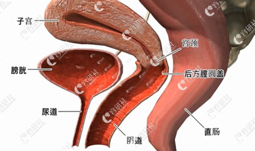 韩国好手艺子宫复位健康术（后方膣圆盖术）示意图