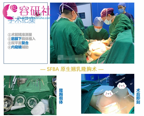 北京联合丽格的杨大平教授隆胸手术过程