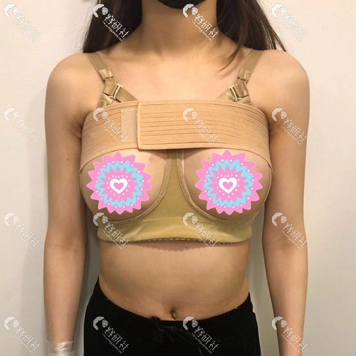 在韩国普罗菲耳做完假体隆胸后穿的塑身衣