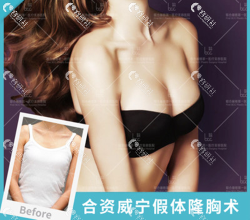 北京联合丽格医疗美容医院杨大平隆胸图片