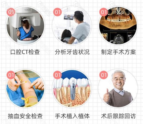 上海中博口腔医院种植牙流程图