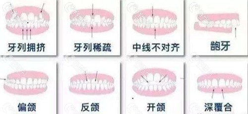 常见的牙齿问题