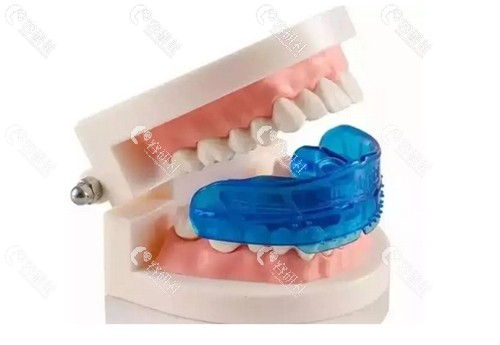 MRC儿童牙齿矫治器