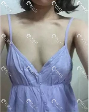 韩国珠儿丽隆胸前的照片