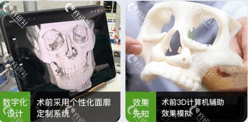 杭州时光的3D打印技术
