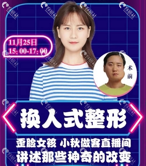 “歪脸女孩”小秋做客沈阳杏林直播间海报