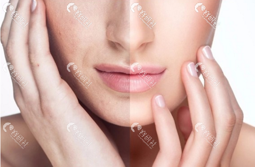 面部松弛衰老和皮肤紧致的差异