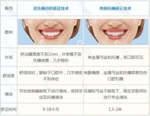绵阳牙牙口腔无托槽隐形矫正和传统托槽矫正区别