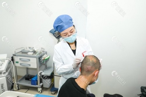 西安国 际医学中心植发科陈娟给发友做检查