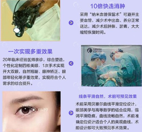 珠海九龙割双眼皮手术优势