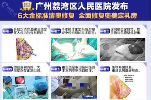 广州荔湾区人民医院奥美定取出手术优势