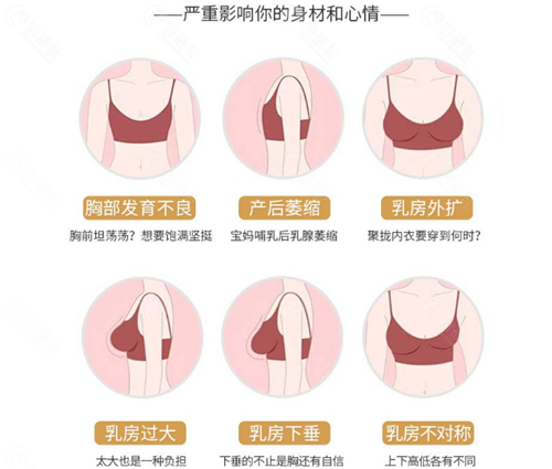 胸部不同的问题很影响身材和心情，广州假体丰胸做的好的医院有哪些？