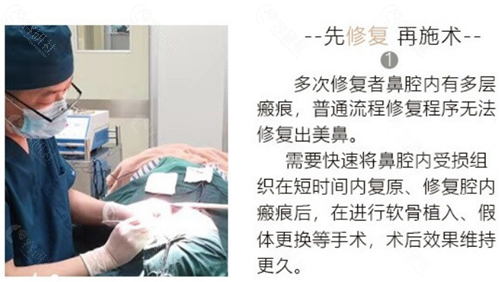 上海光博士鼻修复方法