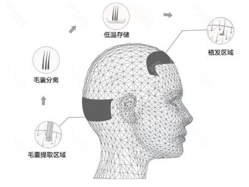 哈尔滨美珊医疗整形植发