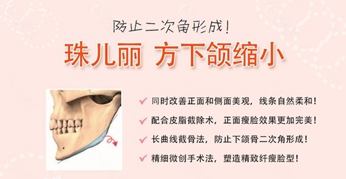 韩国珠儿丽下颌角手术优势