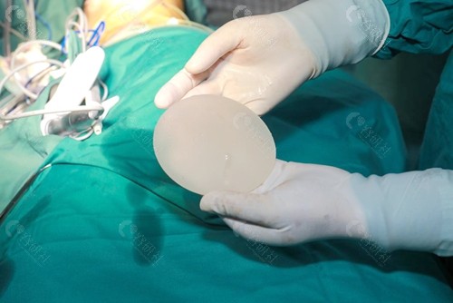 王爱武医生乳房再造术在假体表面增加丰厚的自体软组织来实现好的<span style=