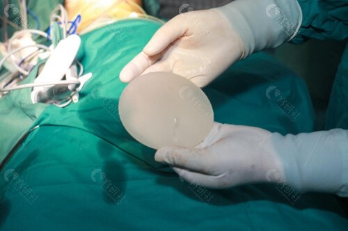 乳房再造手术原理