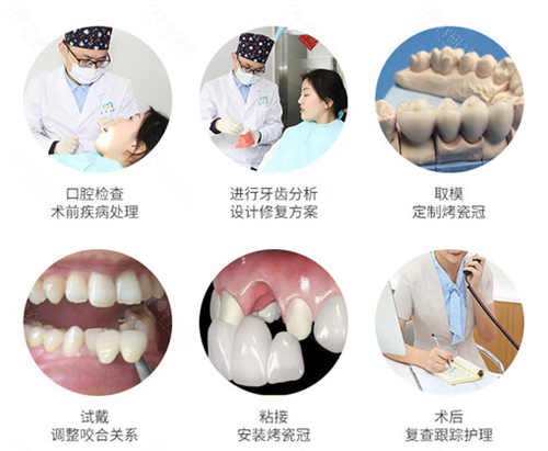 上海永华口腔诊疗流程