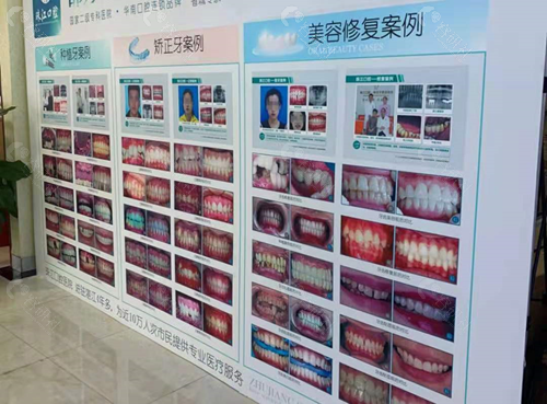湛江珠江口腔医院牙齿矫正对比照