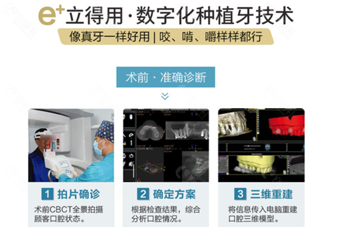 北京中诺口腔医院数字化种植牙技术展示图