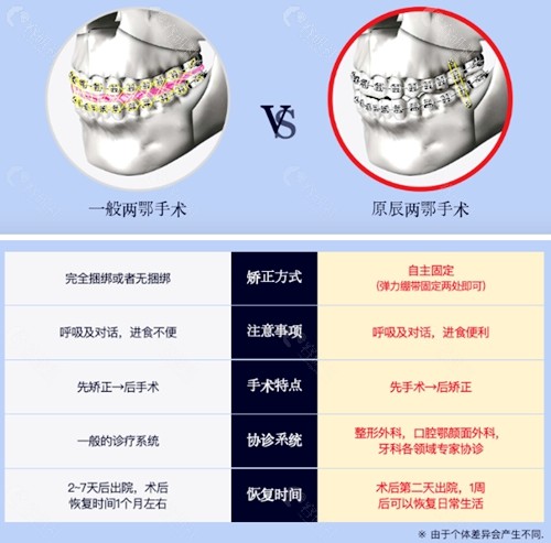 一般两颚手术与原辰自主捆绑两颚手术优劣势对比