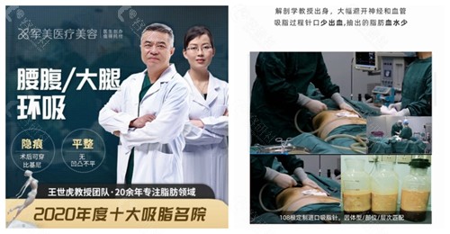 广州军美医疗美容做大腿吸脂手术的医生团队