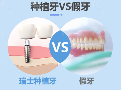 种植牙和假牙的区别