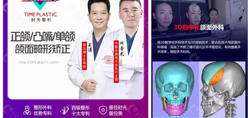上海时光整形外科医院正颌手术