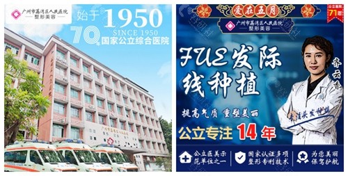 广州荔湾区人民医院发际线种植