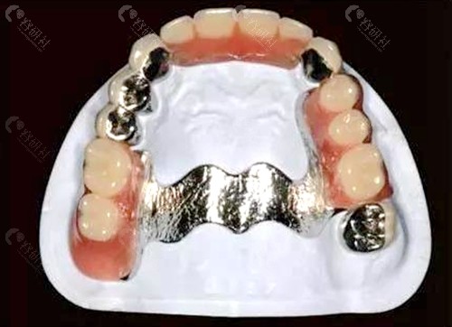 临床上常见的补牙材料银汞合金