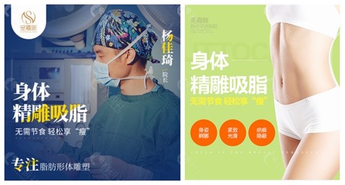 北京圣嘉新医疗美容口腔医院精塑吸脂