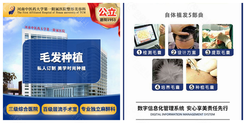 郑州中医大学第 一附属医院植发5个环节