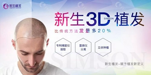 苏州新生医疗美容植发机构3D植发