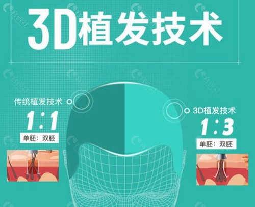 深圳新生3D植发技术优势介绍